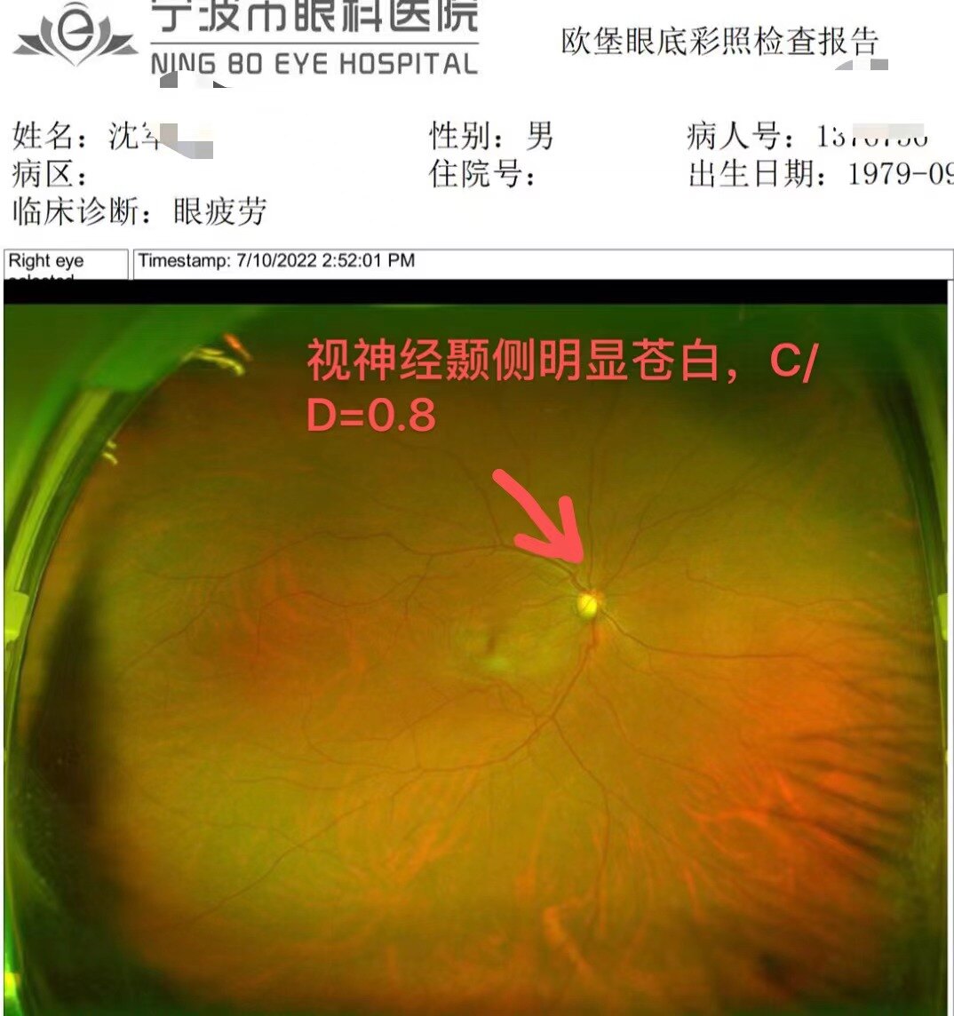 打手机游戏会得青光眼吗_青光眼能玩游戏吗_青光眼可以打游戏吗
